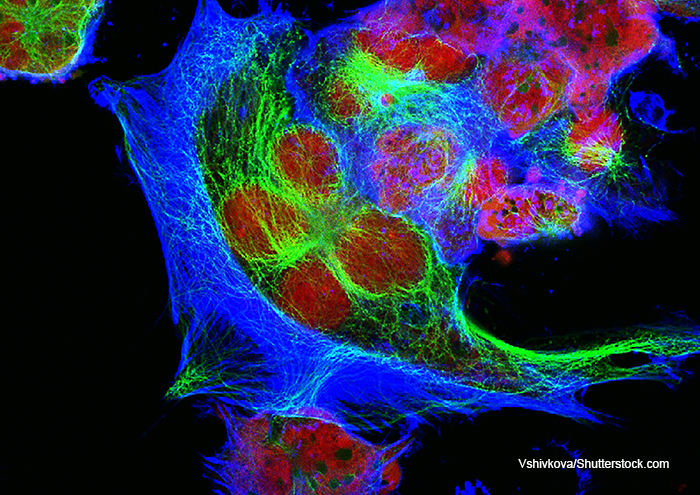 human neuroblastoma cells